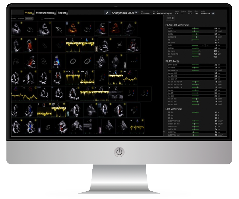 1Echo Screenshot